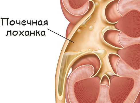 Как зайти на кракен через айфон